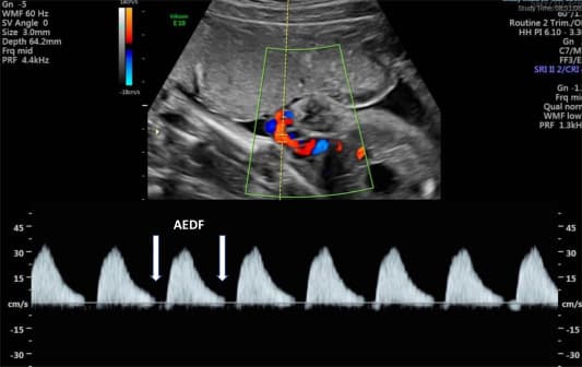 Doppler Obstetrics